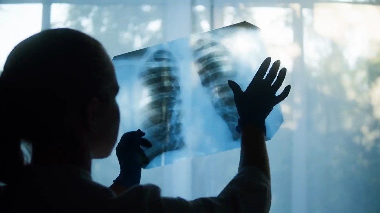 Terrebonne General To Your Health 1/13: COPD