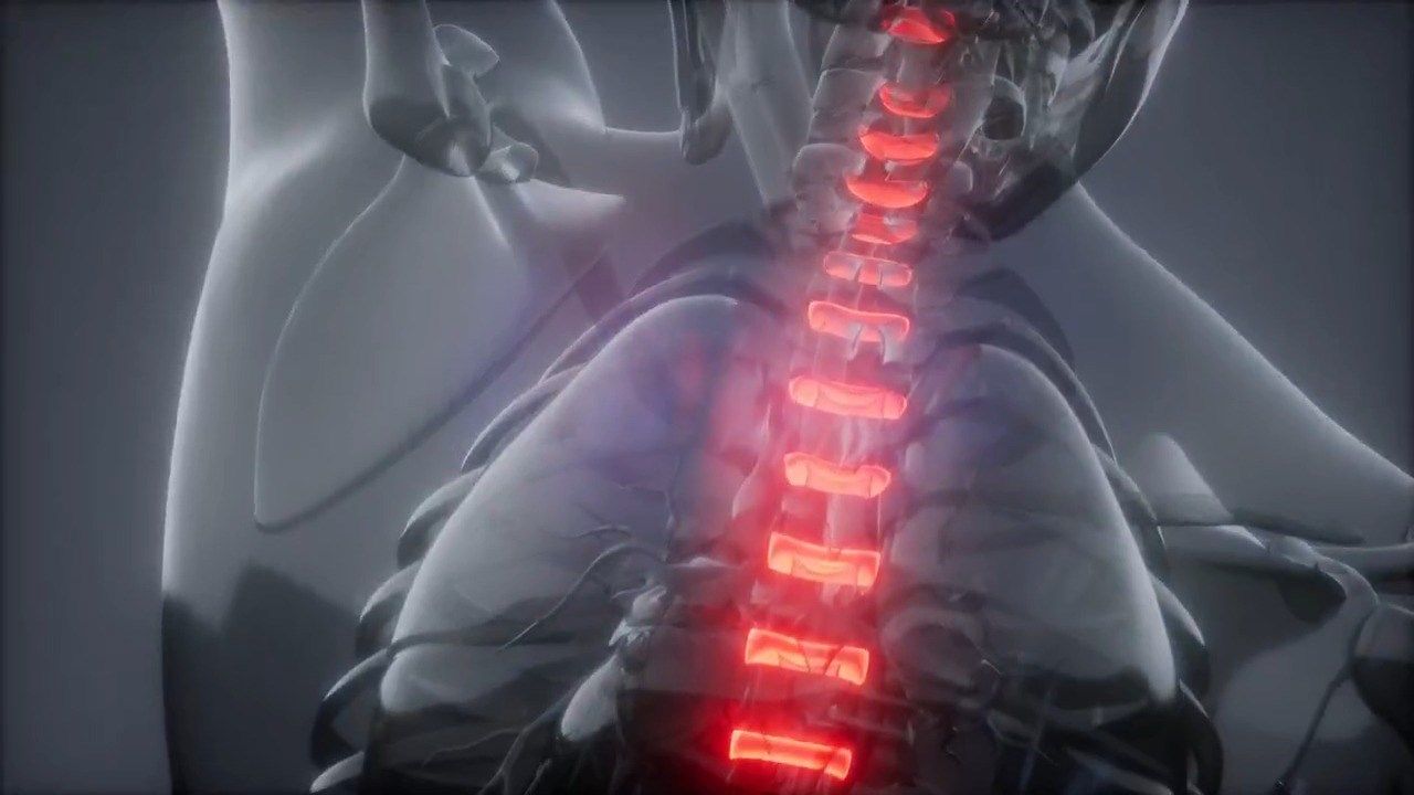 Terrebonne General To Your Health: The Future of Spine Surgery